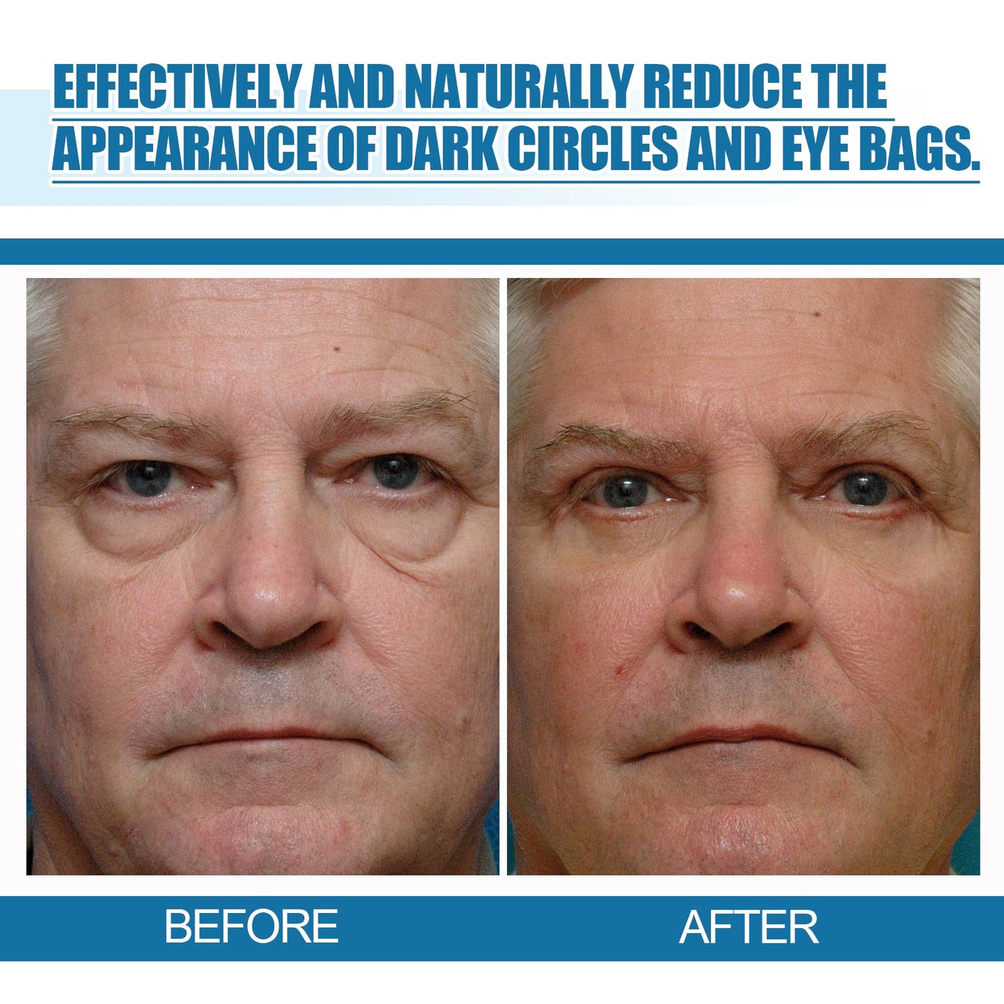 Men's Eye Serum Reduces Fine Lines, Bags, Dark Circles, Moisturizes, Firming, Brightening And Anti-Aging Eye Area