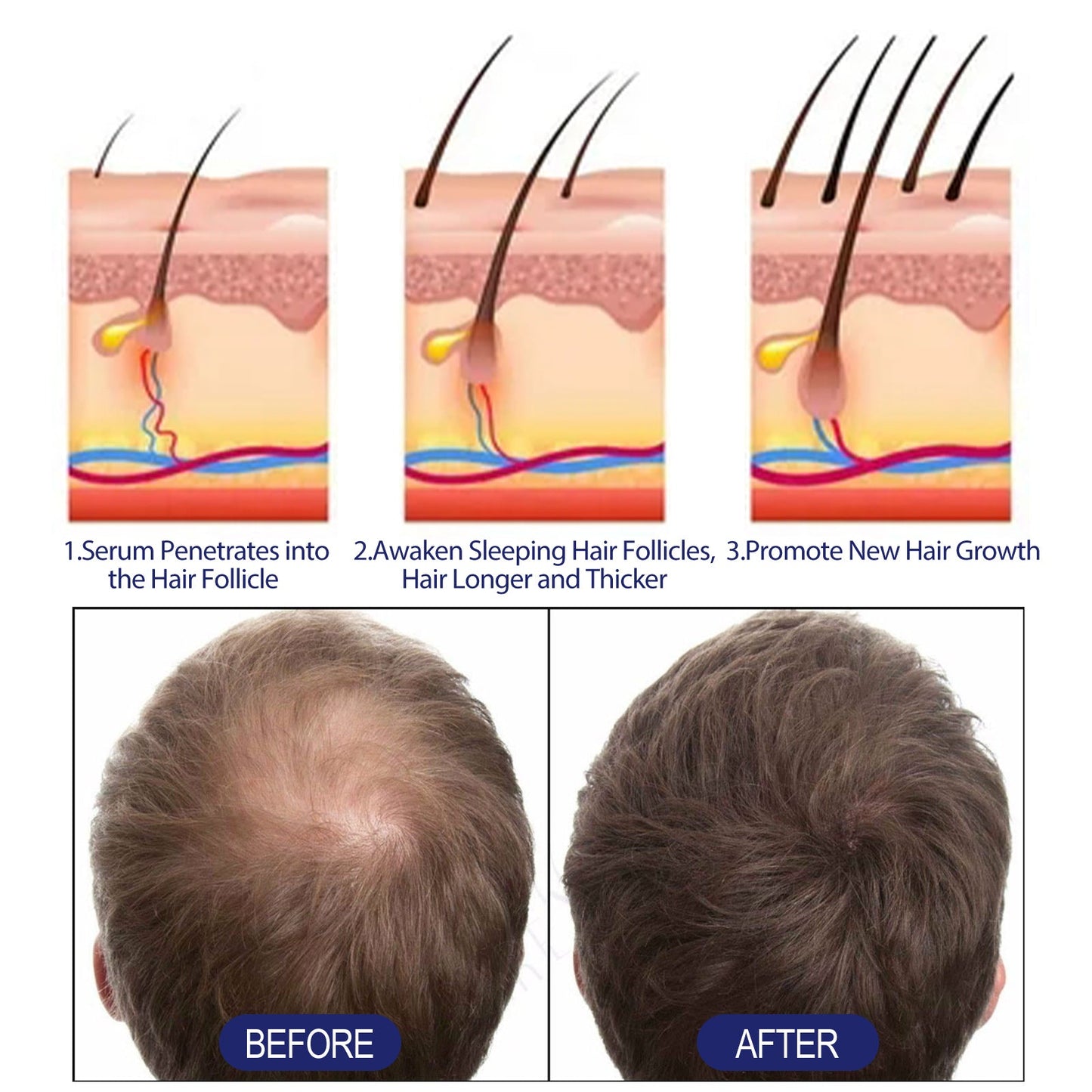 Men's Dense Hair Foam Machine, Repair Hair Root Follicle Men's Hair Thick Moisturizing Foam