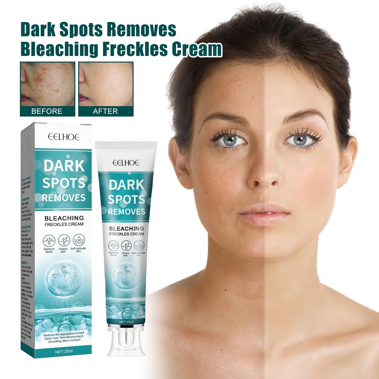 Whitening Spot Cream Hydrates And Moisturizes Skin To Lighten Spots, Acne Whitening, Brightening And Rejuvenating Skin Beauty Cream