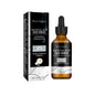 Salicylic Acid Facial Essence, Lighten Acne Mark Repair Hydrating Facial Care Essence