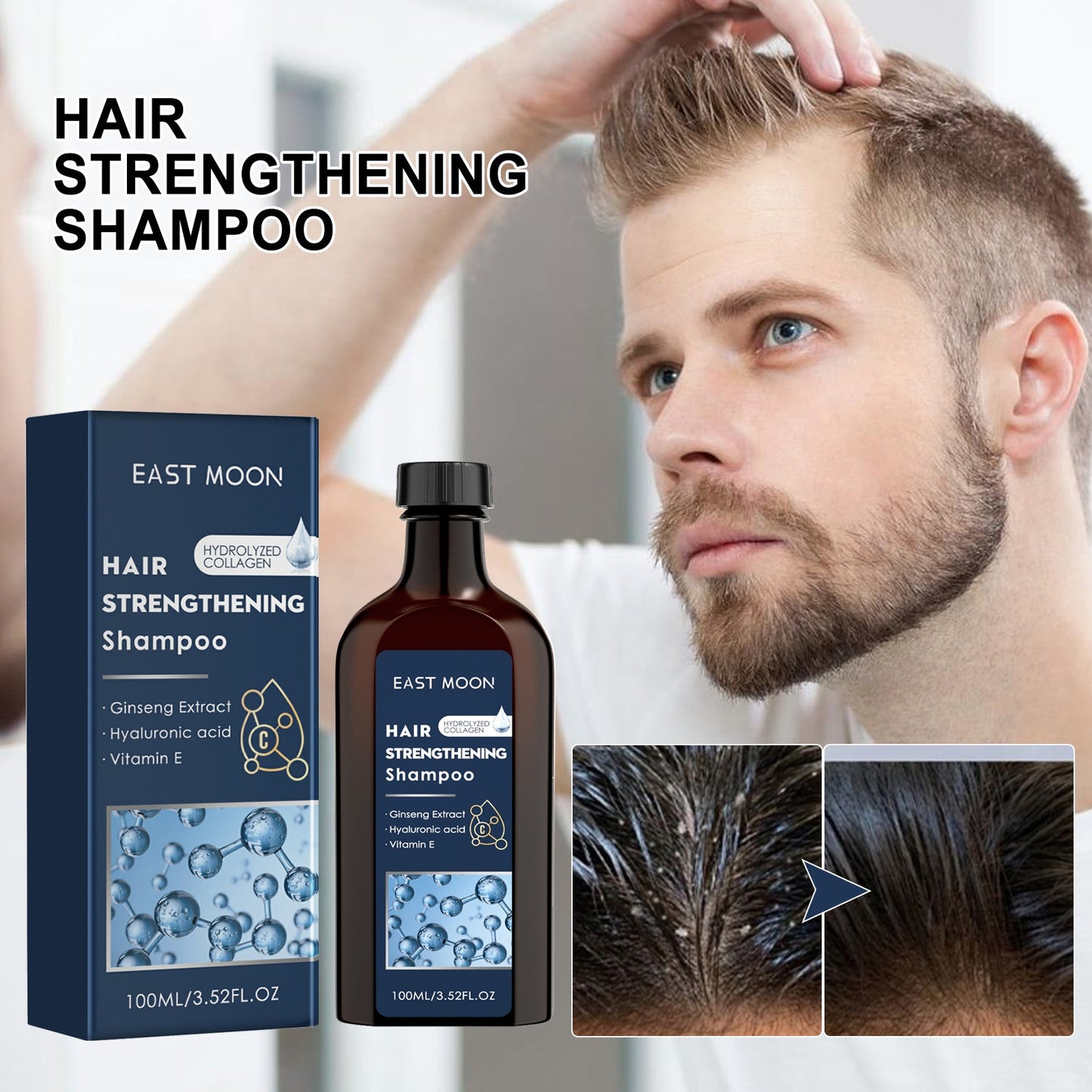 Men's Shampoo Deep Clean Moisturizing Root And Scalp Massage Nourishing Treatment Shampoo
