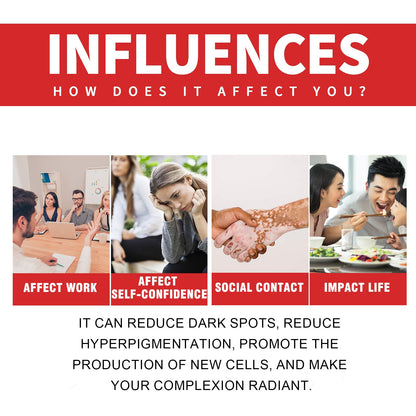 Dark Spot Whitening Cream, Lightening Yellow Brown White Spot Cream Dark Spots Correct Skin Tone Moisturize Skin Whitening
