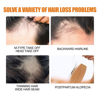 Hair Growth Spray, Men Hair And Beard Thickening Strengthening Anti-loss Care Solution